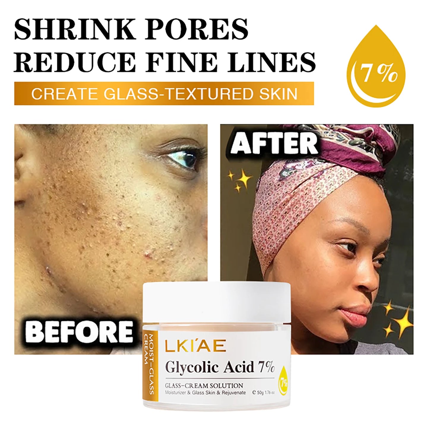 Glycolic Acid 7% Whitening Serum