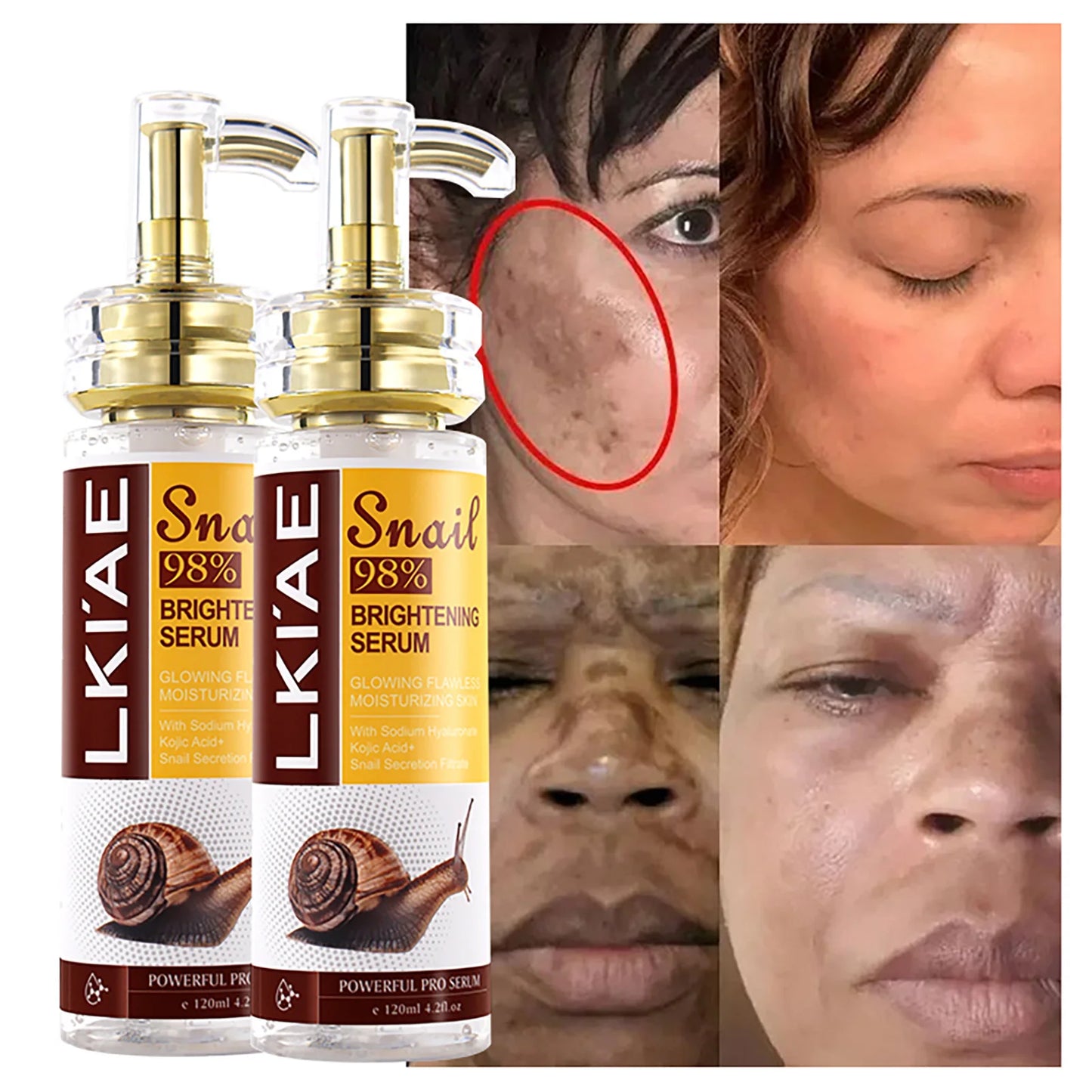 120ml Whitening Snail Serum