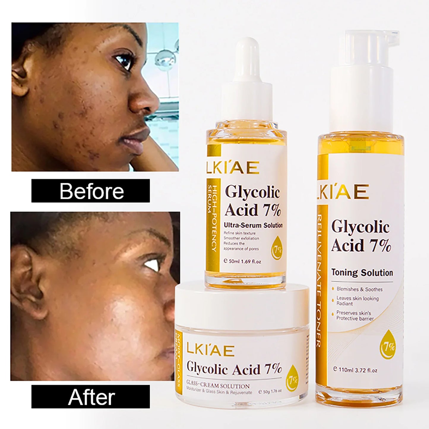 Glycolic Acid 7% Whitening Serum
