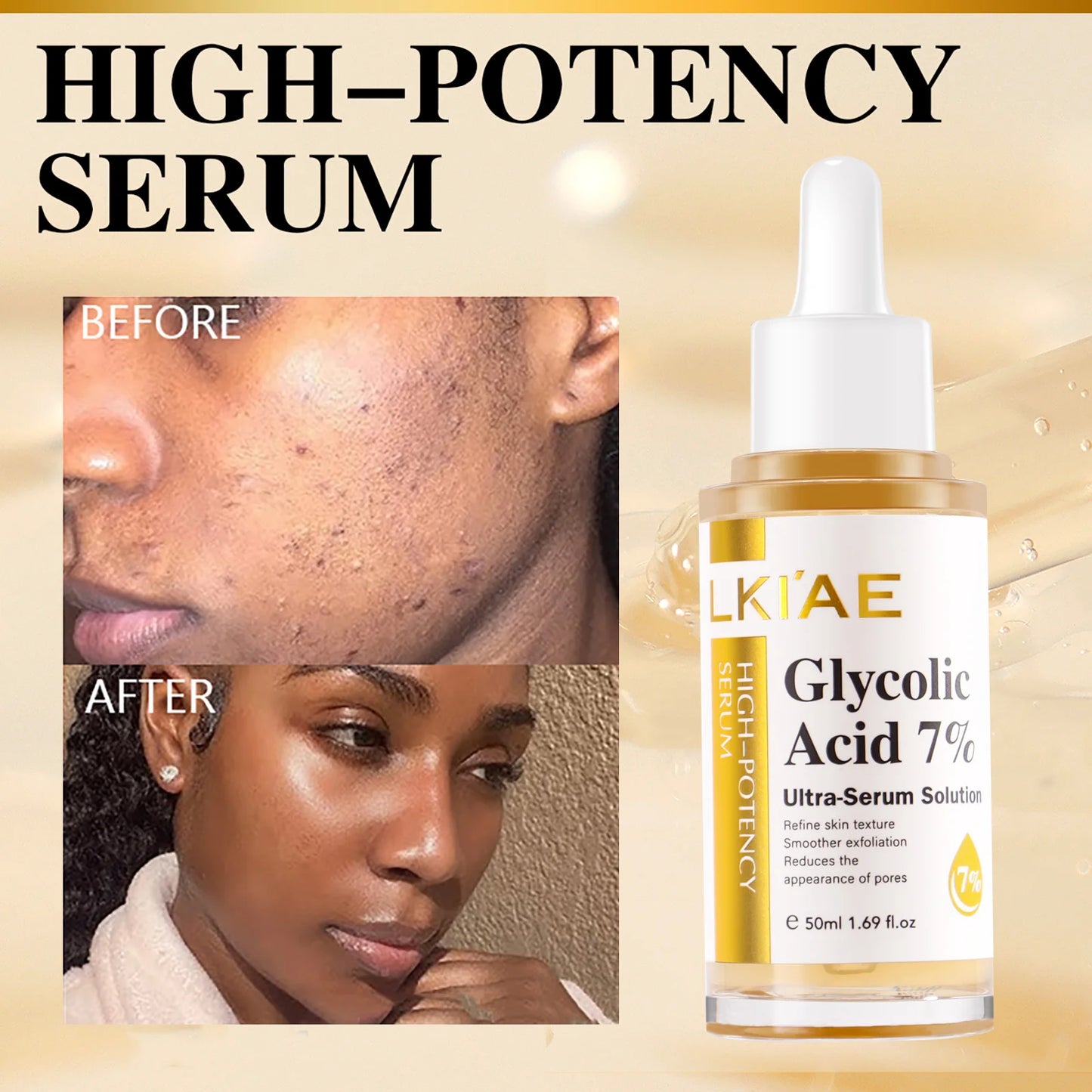 Glycolic Acid 7% Ultra-Serum-Solution