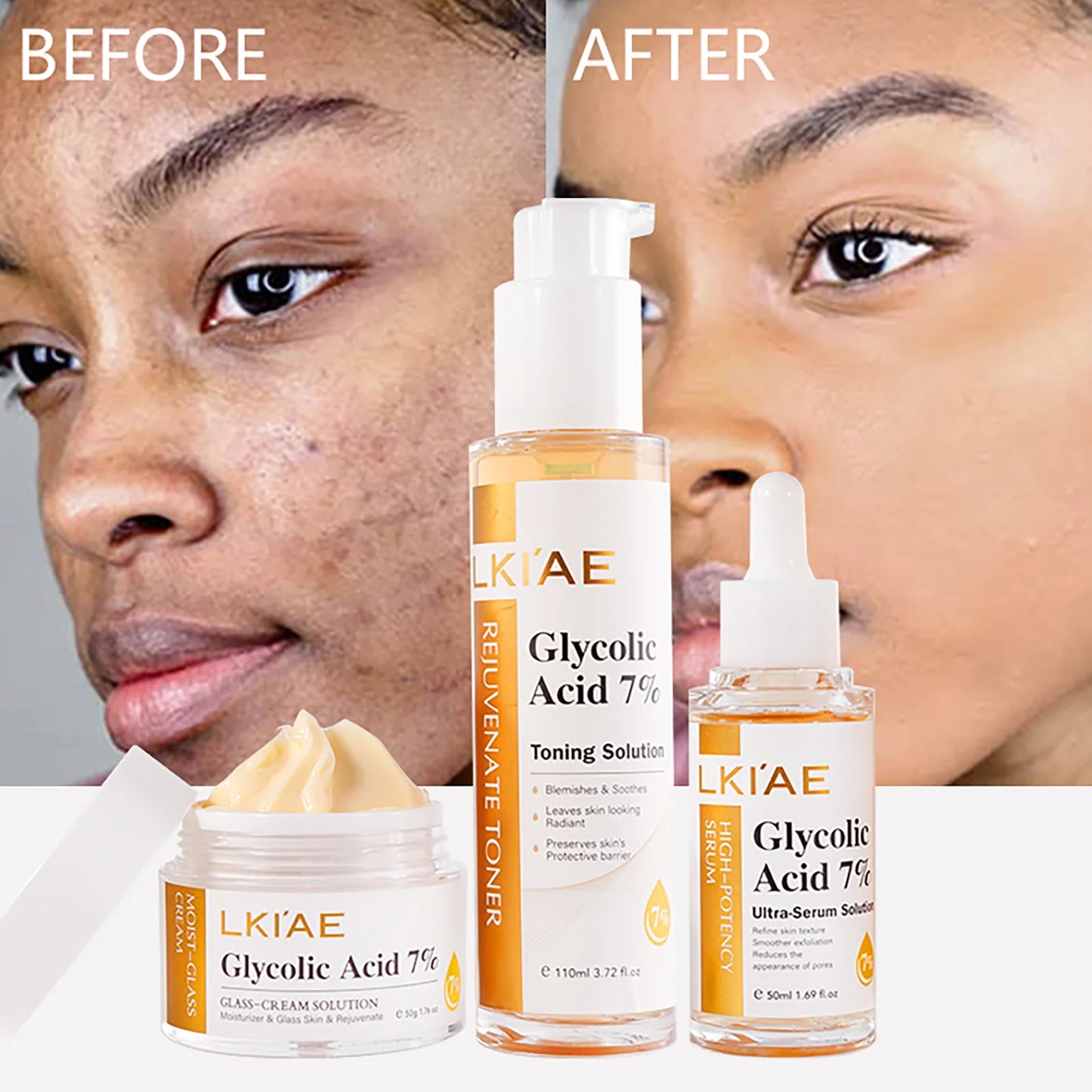 Glycolic Acid 7% Ultra-Serum-Solution