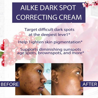 Dark Spots Remover Cream For Armpit, Elbows
