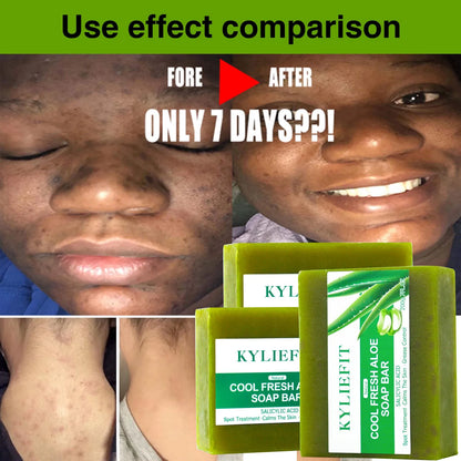 Aloe Brightening Soap Bar