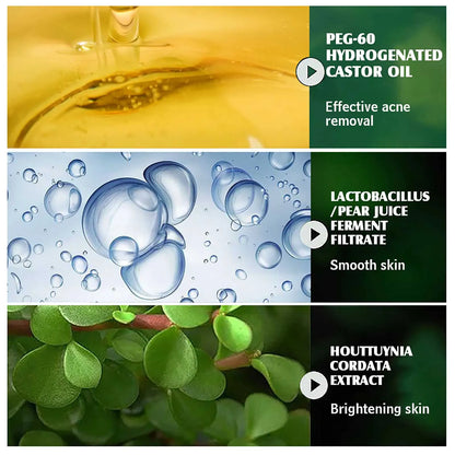 Acne Breakouts Removal Cream