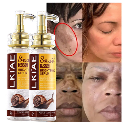 120ml Whitening Snail Serum
