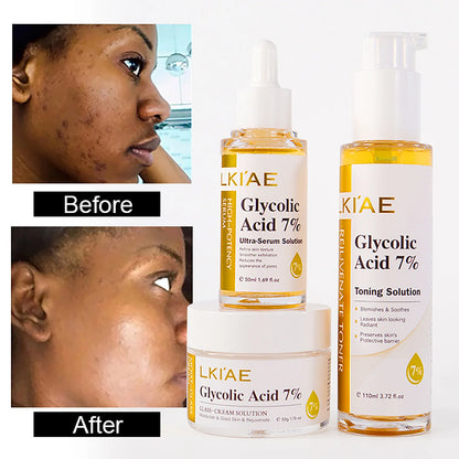 Glycolic Acid 7% Whitening Serum