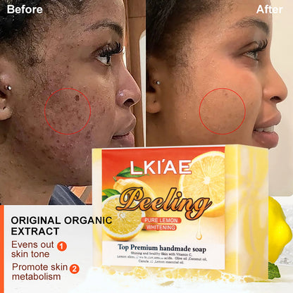 Pure Lemon Whitening Handmade Soap